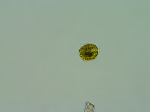 Alexandrium is a genus of dinoflagellates that leads to Paralytic Shellfish Poisoning. This cell was identified by a team of researchers at NOAA’s biotoxin testing lab in Seattle. (Photo courtesy of NOAA).
