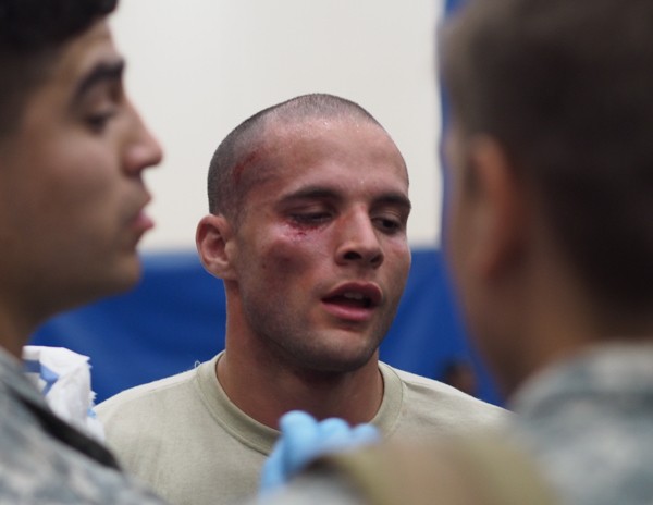 Specialist Noah Meyes gets cleaned up after winning the Cruiser-weight division. In spite of a concussion, 13 facial stitches, and a dislocated elbow, organizers were pleased with the low number of injuries. Combatives tournaments have been scrapped at other Army bases out of injury concerns. (Photo: Zachariah Hughes, KSKA)