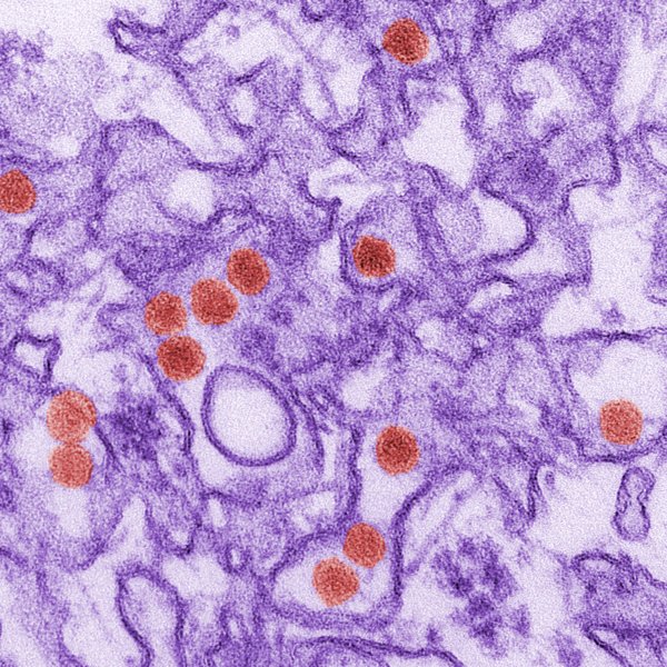 A digitally-colorized transmission electron micrograph (TEM) of Zika virus. Andrea Ferrante hopes that the use of peptides will allow for vaccines for viruses such as Zika. (Wikimedia commons photo courtesy of Center for Disease Control)