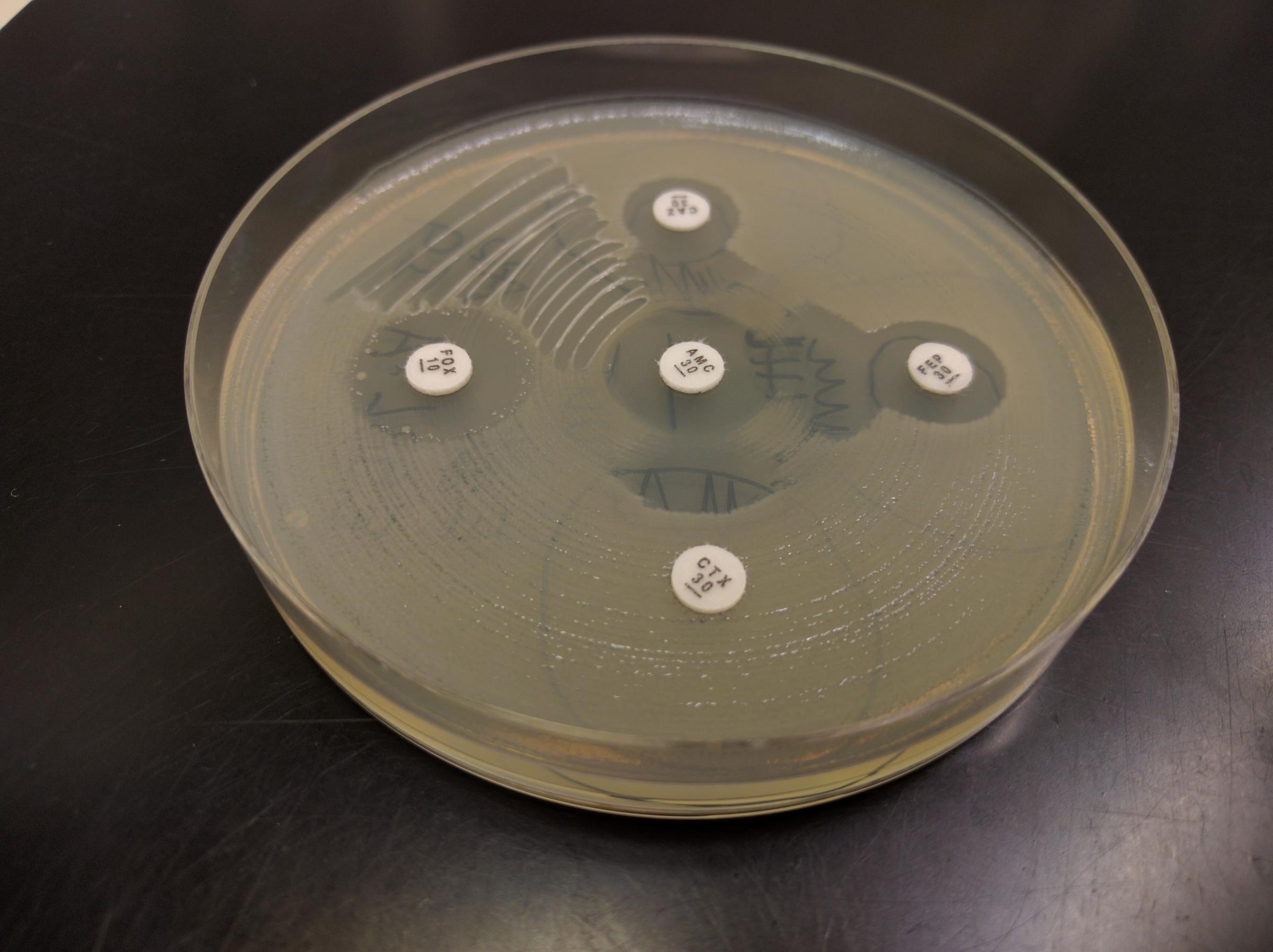 A test for antibiotic resistance. The cloudy film on the petri dish surface are E. coli bacteria and the little white discs contain different antibiotics. If the E. coli are resistant to the antibiotic, they grow right up to the edge of the white disc. If the disc has a little "halo" around it, that means the E. coli are susceptible to the antibiotic. (Photo courtesy of Jonas Bonnedahl)
