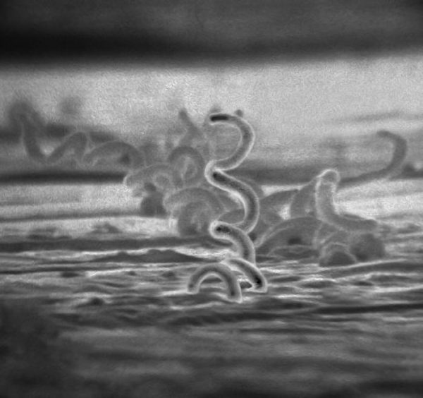 A microscopic black and white image of a syphilis bacteria, which appears as a cork screw shape coming out of a flat surface. 
