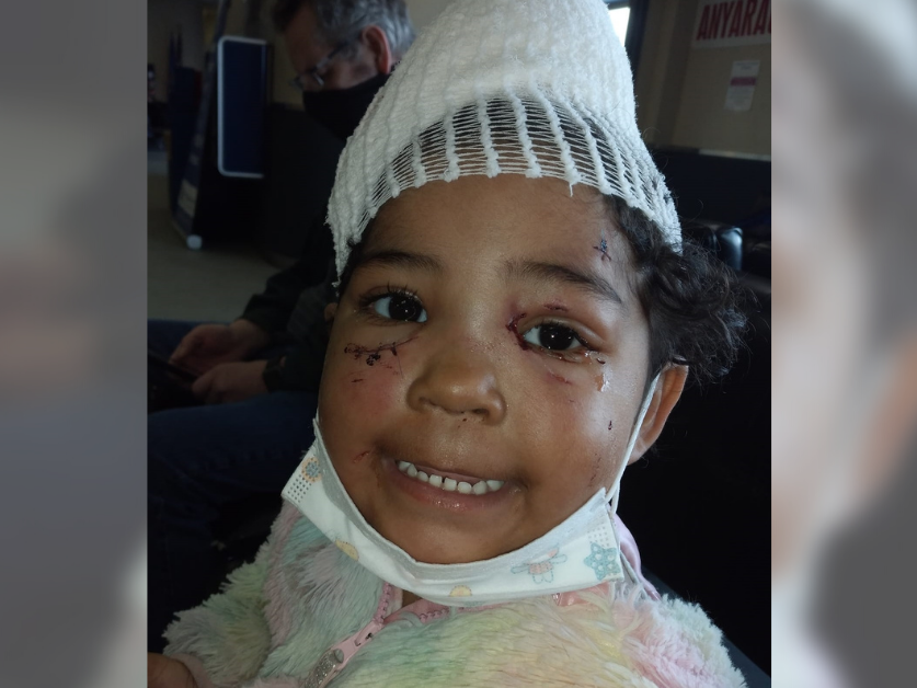 A girld smiles with a bandage on her head and stitches