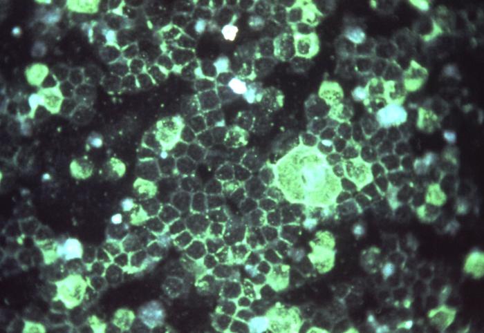 a green and black microscopic image