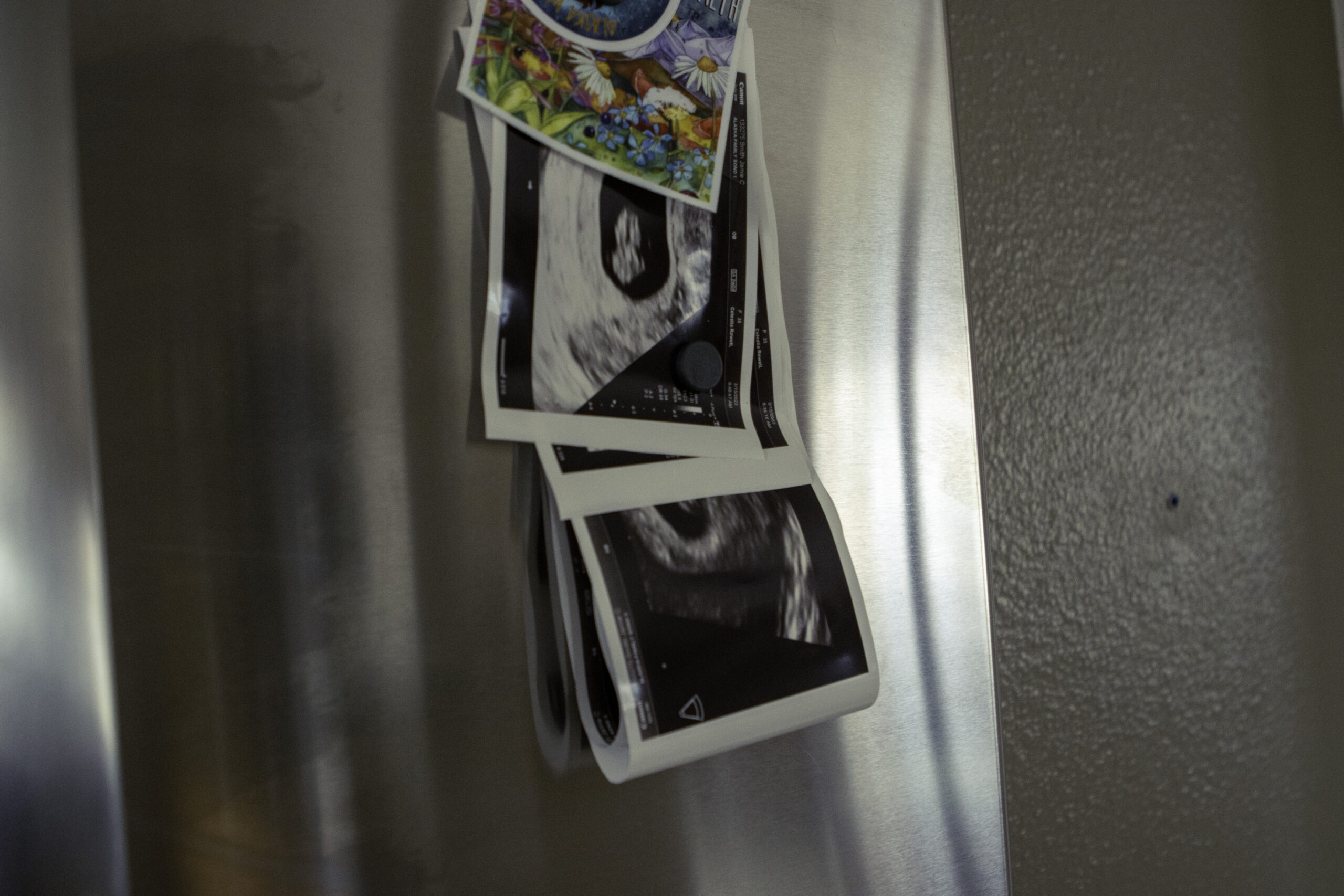 an ultrasound on the refrigerator