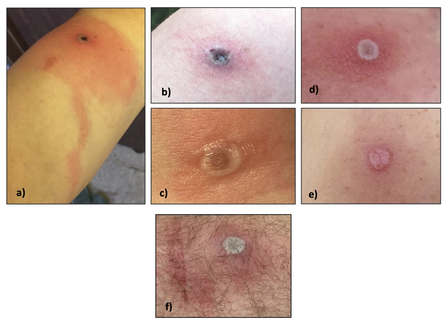 photos of lesions