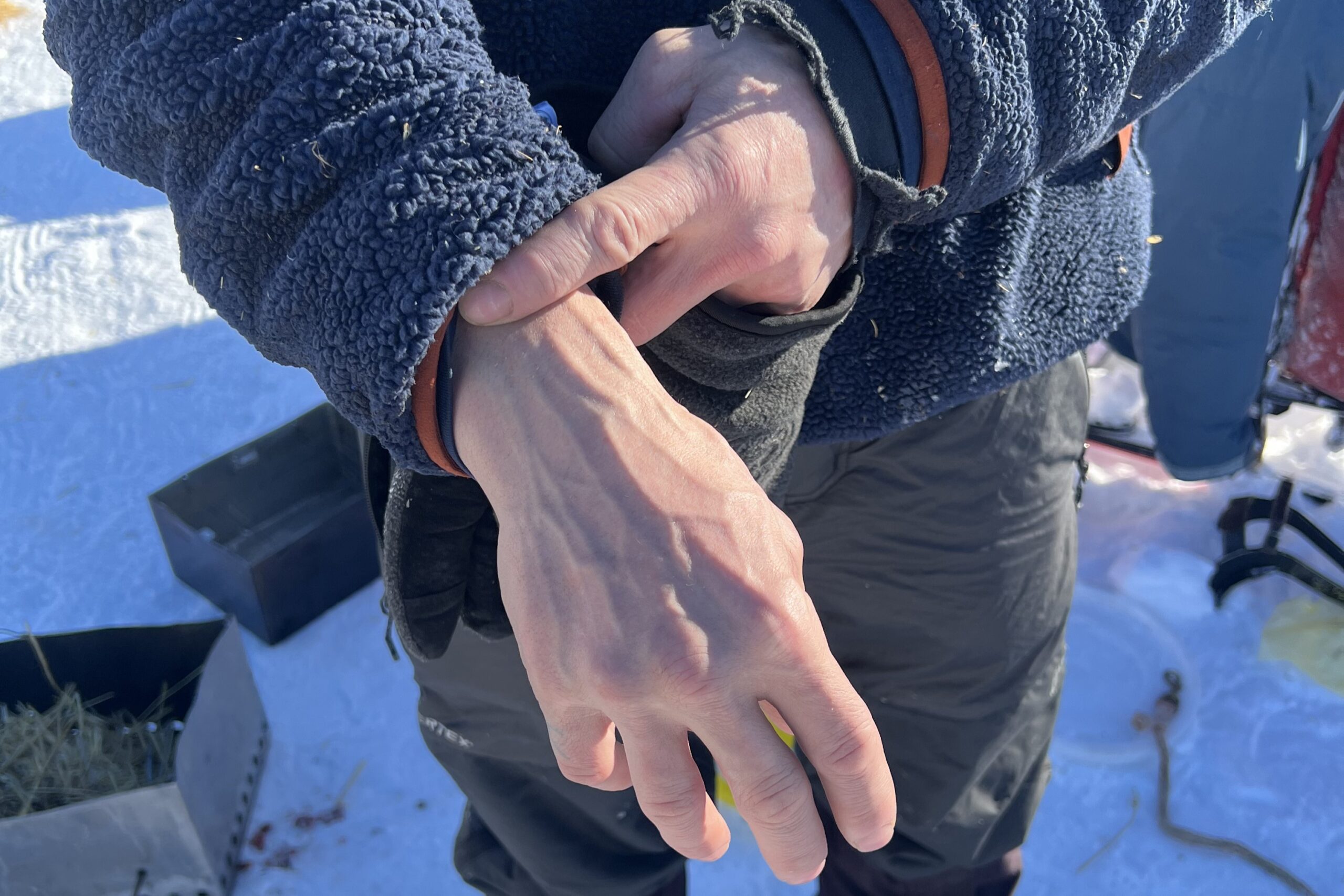 a musher shows his bruised hand