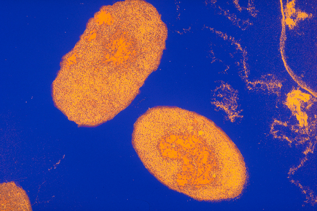 Blobs of orangish float connected a bluish background. 